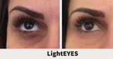 *NEW*  Lighteyes! Purchase (4) Treatments!