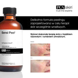 PCA SENSI PEEL: PURCHASE 3 PCA SENSI PEELS, RECEIVE COMPLIMENTARY POST-PROCEDURE SOLUTION KIT ($50 VALUE) WITH EVERY PURCHASE!