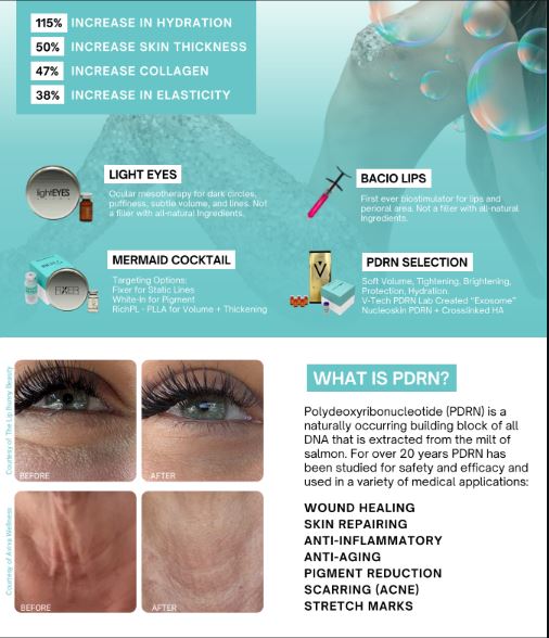 *NEW* Profusion PDRN Facial!! Purchase (4) Treatments!