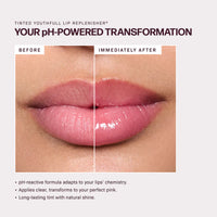 *NEW* Bacio Lips!! Purchase 4 Treatments