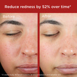 EltaMD UV Skin Recovery Broad Spectrum SPF 50 Face Sunscreen
