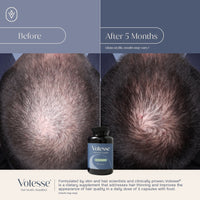 Votesse Hair Supplement
