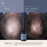 Votesse Hair Supplement