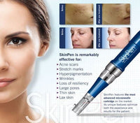Vampire Facial Package: (4) Vampire Facials (SkinPen Microneedling + PRP) Plus a 90 day supply of Biojuve Cleanser, Biojuve Essentials Duo, and Biome Support Complex