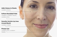 20% Off Selective Dermal Fillers