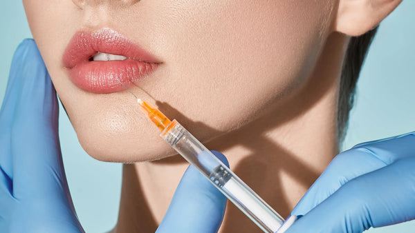 Kyssable Lip Package: PURCHASE (1) SYRINGE OF LIP FILLER (Restylane Kysse), Receive complimentary Lip Flip